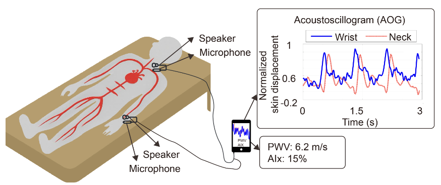 Acoustoscillogram system figure
